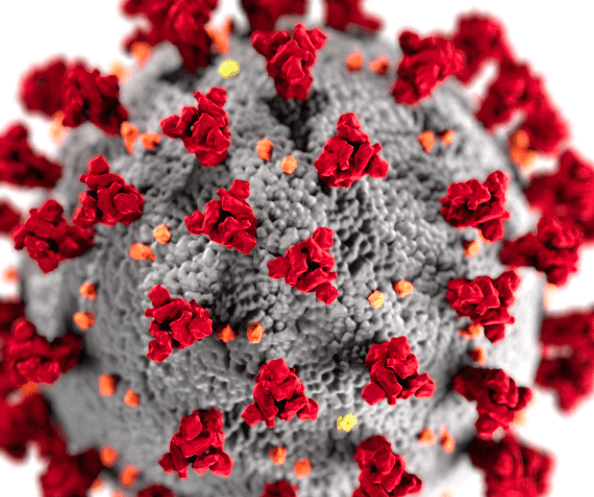 Coronavirus and the impact on business so far. Working remotely makes the decision of whether to choose SAGE versus Intuit more interesting